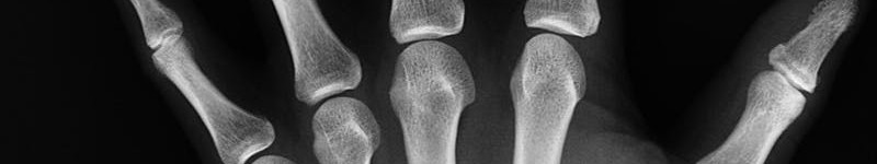 bone x-ray